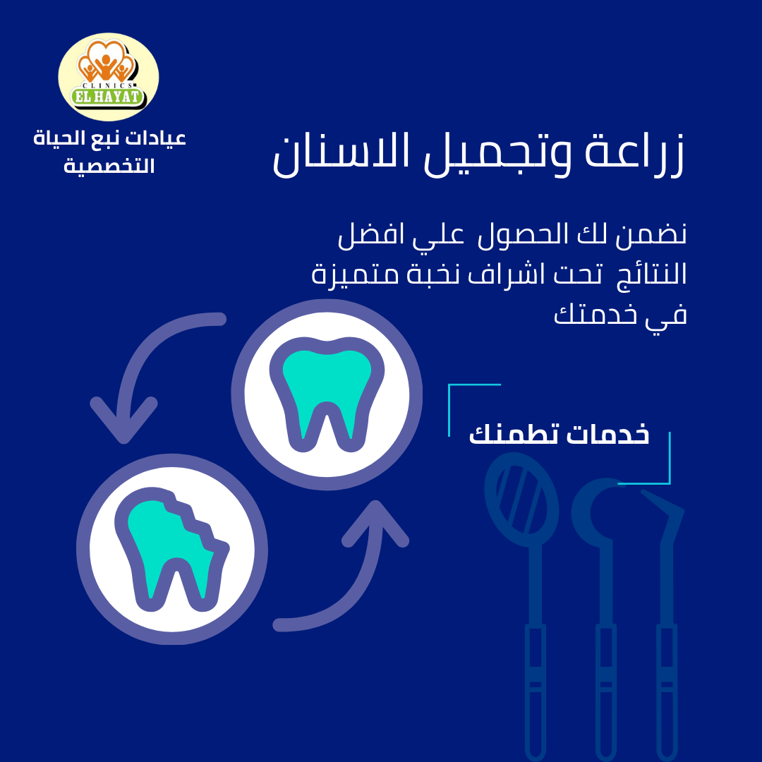 تقنيات حديثة في زراعة الأسنان: خيارات متطورة لابتسامة جميلة