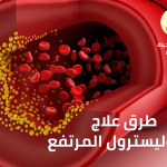 علاج كوليسترول